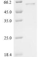 Human Z-DNA-binding protein 1 (ZBP1) Recombinant Protein, N-His - BioCrest Sci