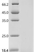 Bovine Muellerian-inhibiting factor (AMH), partial Recombinant Protein, N-His - BioCrest Sci