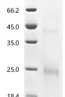 Rat Ly6/PLAUR domain-containing protein 3 (Lypd3) Recombinant Protein, N-His - BioCrest Sci