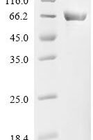 Escherichia coli Arginine--tRNA ligase (argS) Recombinant Protein - BioCrest Sci