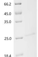 Human Ras-related protein Rab-27A (RAB27A) Recombinant Protein - BioCrest Sci