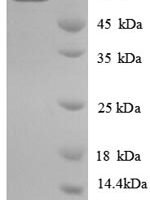 E.coli Long-chain-fatty-acid--CoA ligase (fadD) Recombinant Protein - BioCrest Sci