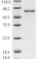 Human Monoglyceride lipase (MGLL) Recombinant Protein - BioCrest Sci