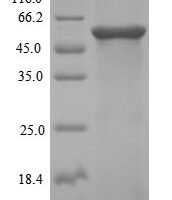 Human Desmoglein-3 (DSG3), partial Recombinant Protein, N-His-SUMO, aa 70–499 - BioCrest Sci