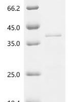 Bordetella pertussis BrkA autotransporter (brkA), partial Recombinant Protein, C-His, aa 202–495 - BioCrest Sci