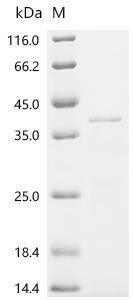 Bordetella pertussis BrkA autotransporter (brkA), partial Recombinant Protein, C-His, aa 202–495, Bordetella pertussis (strain Tohama I / ATCC BAA-589 / NCTC 13251), E.coli, C-terminal 6xHis-tagged, 35.3 kDa, purity >≥ 85% as determined by SDS-PAGE.