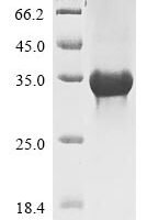 Human SPRY domain-containing SOCS box protein 1 (SPSB1) Recombinant Protein, N-His - BioCrest Sci