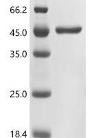 Human Fructose-bisphosphate aldolase B (ALDOB) Recombinant Protein - BioCrest Sci