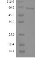 Human Semenogelin-2 (SEMG2) Recombinant Protein, N-His - BioCrest Sci