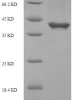 Rat Suppressor of cytokine signaling 3 (Socs3) Recombinant Protein, N-His-SUMO - BioCrest Sci