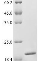 Mouse Titin (Ttn), partial Recombinant Protein - BioCrest Sci
