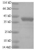 Human papillomavirus type 18 Regulatory protein E2 (E2) Recombinant Protein, N-His, aa 1–365, Yeast - BioCrest Sci