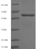 Human B-cell lymphoma/leukemia 10 (BCL10) Recombinant Protein - BioCrest Sci