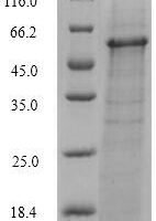 Vibrio vulnificus Fe/S biogenesis protein NfuA (nfuA) Recombinant Protein, C-hFc1 - BioCrest Sci
