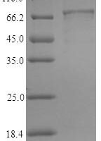 Human Retinaldehyde dehydrogenase 3 (ALDH1A3) Recombinant Protein, N-His-SUMO - BioCrest Sci