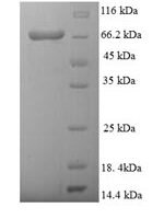 Danio rerio D-2-hydroxyglutarate dehydrogenase, mitochondrial (d2hgdh) Recombinant Protein - BioCrest Sci