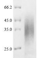 Streptococcus agalactiae serotype III Single-stranded DNA-binding protein 1 (ssb1) Recombinant Protein, C-His, aa 1–163, Yeast - BioCrest Sci