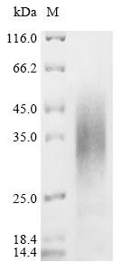 Streptococcus agalactiae serotype III Single-stranded DNA-binding protein 1 (ssb1) Recombinant Protein, C-His, aa 1–163, Yeast, Streptococcus agalactiae serotype III (strain NEM316), Yeast, C-terminal 6xHis-tagged, 19.9 kDa, purity >≥ 85% as determined by SDS-PAGE.