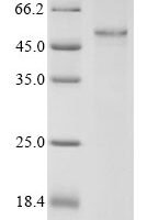 Mouse Forkhead box protein P3 (Foxp3) Recombinant Protein - BioCrest Sci