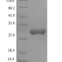 Prevotella intermedia Alkaline phosphatase Recombinant Protein - BioCrest Sci