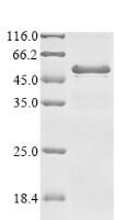 Human UV excision repair protein RAD23 homolog A (RAD23A) (T131A) Recombinant Protein - BioCrest Sci