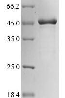 Human Putative beta-actin-like protein 3 (POTEKP) Recombinant Protein - BioCrest Sci