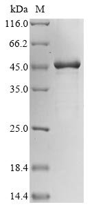 Human Putative beta-actin-like protein 3 (POTEKP) Recombinant Protein, Homo sapiens (Human), E.coli, N-terminal 10xHis-tagged and C-terminal Myc-tagged, 49.5 kDa, purity >≥ 85% as determined by SDS-PAGE.