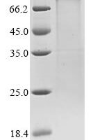 Human coronavirus 229E Spike glycoprotein (S), partial Recombinant Protein, C-10His - BioCrest Sci