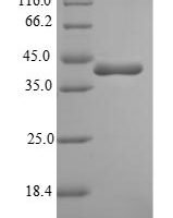Bacillus subtilis Penicillin-binding protein 4 (pbpD), partial Recombinant Protein - BioCrest Sci