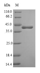 Bacillus subtilis Penicillin-binding protein 4 (pbpD), partial Recombinant Protein, Bacillus subtilis (strain 168), E.coli, N-terminal 6xHis-SUMO-tagged, 43.0 kDa, purity >≥ 90% as determined by SDS-PAGE.