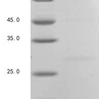 Human Platelet-derived growth factor subunit B (PDGFB) Recombinant Protein, C-His - BioCrest Sci