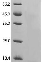 Plasmodium vivax Circumsporozoite protein (CSP), partial Recombinant Protein - BioCrest Sci