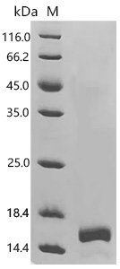 Plasmodium vivax Circumsporozoite protein (CSP), partial Recombinant Protein, Plasmodium vivax (strain Salvador I), E.coli, N-terminal 10xHis-tagged and C-terminal Myc-tagged, 13.1 kDa, purity >≥ 85% as determined by SDS-PAGE.