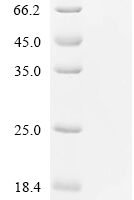 Mouse Calcitonin gene-related peptide 2 (Calcb) Recombinant Protein - BioCrest Sci