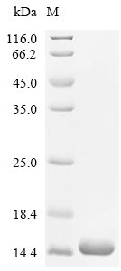 Mouse Calcitonin gene-related peptide 2 (Calcb) Recombinant Protein, Mus musculus (Mouse), E.coli, C-terminal 6xHis-tagged, 10.8 kDa, purity >≥ 95% as determined by SDS-PAGE.
