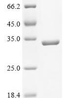 Enterobacteria phage T4 Sliding clamp (45) Recombinant Protein - BioCrest Sci