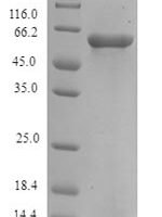 Human Protein FAM46C (FAM46C) Recombinant Protein, N-His-SUMO - BioCrest Sci