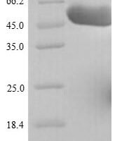 Human Rab GDP dissociation inhibitor beta (GDI2) Recombinant Protein, N-His - BioCrest Sci