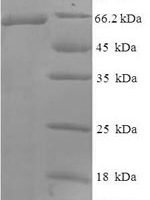 Human Wilms tumor protein (WT1) Recombinant Protein, N-His-SUMO - BioCrest Sci