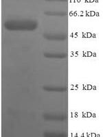 Human Serine protease 23 (PRSS23) Recombinant Protein - BioCrest Sci