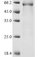 Human Serine racemase (SRR) Recombinant Protein, N-His-GST - BioCrest Sci