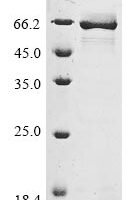 Escherichia coli Periplasmic oligopeptide-binding protein (oppA) Recombinant Protein - BioCrest Sci
