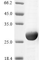 Mouse Ras-related protein Rab-10 (Rab10) Recombinant Protein - BioCrest Sci