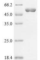 Rabbit 4F2 cell-surface antigen heavy chain (SLC3A2), partial Recombinant Protein - BioCrest Sci
