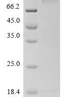Human Amyloid beta A4 precursor protein-binding family A member 2 (APBA2) Recombinant Protein - BioCrest Sci