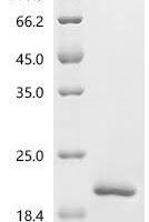 Simian retrovirus SRV-1 Gag polyprotein (gag), partial Recombinant Protein, C-His, aa 2–100, Yeast - BioCrest Sci