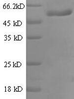 Human Ras-related GTP-binding protein A (RRAGA), partial Recombinant Protein - BioCrest Sci