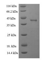 Human Docking protein 5 (DOK5), partial Recombinant Protein - BioCrest Sci