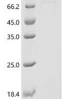 Human BBSome complex member BBS1 (BBS1), Biotinylated Recombinant Protein - BioCrest Sci