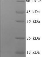 Human Phosphoacetylglucosamine mutase (PGM3) Recombinant Protein - BioCrest Sci